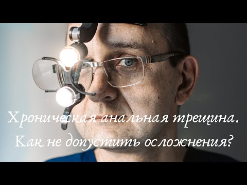 Можно Ли Заниматься Анальным Сексом После Кс